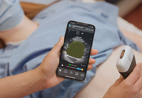Ecografia Point of Care e Clarius. Diagnóstico em tempo real