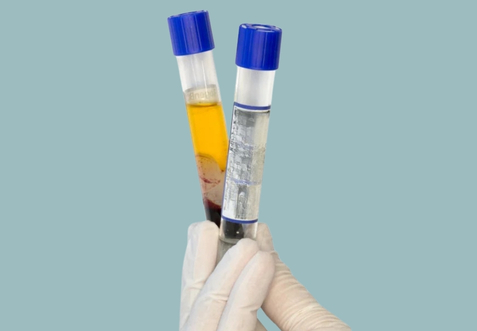 PRP: o trunfo da Medicina Regenerativa